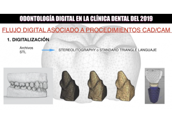  Odontología digital en la clínica dental