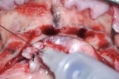 videoImg